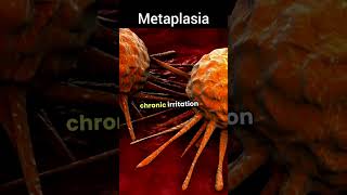 Metaplasia pharmacy cancer science shorts nursing biology [upl. by Clippard]