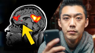 What Loneliness Does to Your Brain [upl. by How442]