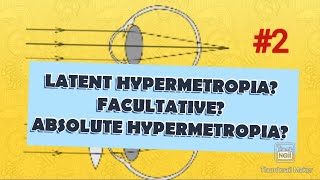 HYPERMETROPIA  What is latent hypermetropia  manifest hypermetropia facultative hypermetropia [upl. by Amund]