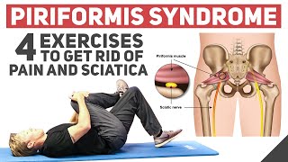 Piriformis Syndrome  Home Stretches amp Exercises [upl. by Brost]