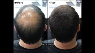 THICK FIBER  Hair Building Fibers is a hair loss concealer fiber Cover up Bald patches [upl. by Buchalter274]