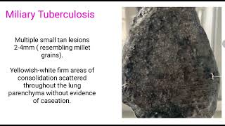 GROSS PATHOLOGY OF MILIARY TUBERCULOSIS [upl. by Lordan]