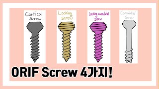 수술용 Screw 40초 안에 구분하기 cortical screw locking screw locking cannulated screw cannulated screw [upl. by Terbecki]