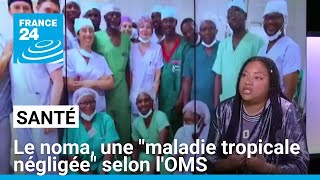 Le noma une quotmaladie tropicale négligéequot selon lOMS • FRANCE 24 [upl. by Nawiat]