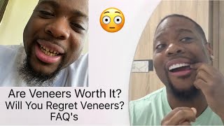 Vlog  My Porcelain Veneer journey 🦷  The Truth About Veneers  Before and After [upl. by Beare889]