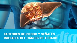 Factores de riesgo y señales iniciales del cáncer de hígado [upl. by Aihsram]