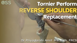 Tornier Perform Reverse Shoulder Replacement  Saw Bone  Surgical Technique  Dr Priyadarshi Amit [upl. by Adnihc]