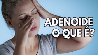 Sobre Adenoide  O que é como tratar [upl. by Ahsap109]