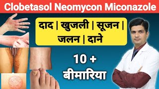 दाद खुजली को ठीक करने की क्रीम । Clobetasol Neomycin and Miconazole cream [upl. by Leahcimnhoj104]