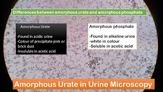 Amorphous Urate and Amorphous phosphate in Urine Microscopy [upl. by Thornie710]