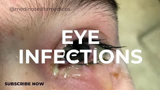 eye infections I MICROBIOLOGY I SECOND YEAR MBBSI USMLE I NEXT [upl. by Nojel939]