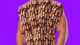 Asmr Remove Dog Ticks And Maggot Infected From BodyAsmr Maggot Animation Treatment ViPasmr01 [upl. by Nnairahs]