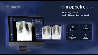 Inspectra CXR AIPowered Chest XRay Analysis  Revolutionizing Medical Diagnostics [upl. by Tegirb]