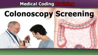 Coding for Screening Colonoscopies — CPT Coding Guidelines [upl. by Harpole]