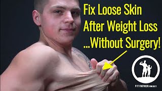 How To Fix Loose Skin After Weight Loss Men Without Surgery 5 Steps [upl. by Aicnarf948]