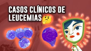 ¿Cómo se observan los FROTIS de SANGRE de pacientes con LEUCEMIA  Casos y células encontradas [upl. by Rehpotsirhk]