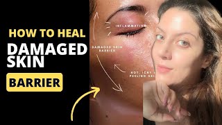 How To Heal Damaged Skin Barrier  How to treat broken skin barrier  Nipun Kapur [upl. by Quill]