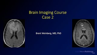 Brain imaging course – Unknown case 2 [upl. by Zsuedat]