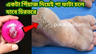 এক রাতে পা ফাটার থেকে মুক্তি পরো ঘরোয়া টিপসcarcked heels treatmentkitchen tipes amphakes [upl. by Ahteres]