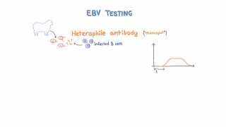 Epstein Barr Virus EBV Diagnosis and Testing [upl. by Roselani805]