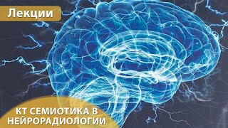 Часть 1 КТ семиотика в нейрорадиологии Андрей Мангов [upl. by Greyso]