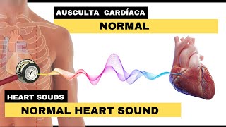 AUSCULTA CARDÍACA NORMAL  Normal Heart Sounds [upl. by Adnohryt]