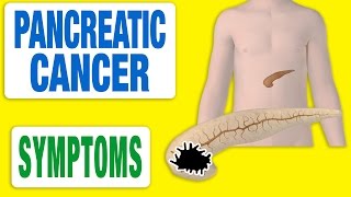 Pancreatic Cancer  All Symptoms [upl. by Garfinkel189]