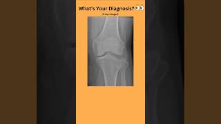 Whats Your Diagnosis 👀radiology radiography doctor nurse medicalstudent medicaltest [upl. by Delwyn]