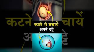 अपना बच्चा करना है ivf [upl. by Solenne]