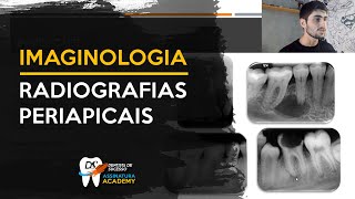 Raio X peripical  Imaginologia para odontologia [upl. by Htebazil271]