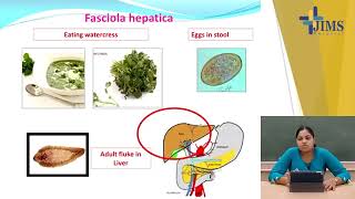 Topic  Trematodes  Part I [upl. by Zia]