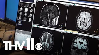 How AI is improving neuroradiology services in Arkansas [upl. by Boiney]