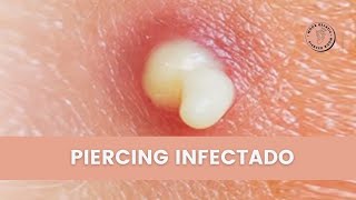 Piercing Infectado ¿Cómo saber si mi perforación esta infectada [upl. by Granlund132]