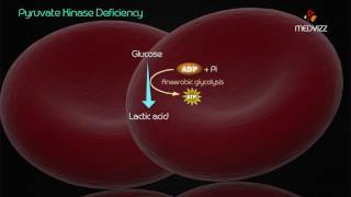 Pyruvate kinase deficiency [upl. by Welcome]