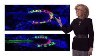 Elaine Fuchs Rockefeller HHMI 2 Tapping the Potential of Adult Skin Stem Cells [upl. by Widera]