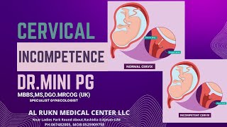 Cervical Incompetence  Cervical insufficency  Dr mini pg  ajman doctor youtube [upl. by Enos]