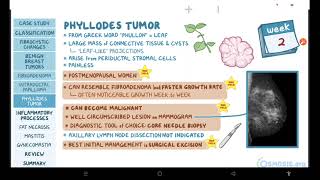 Benign breast conditions  pathology review  Osmosis [upl. by Airotel]