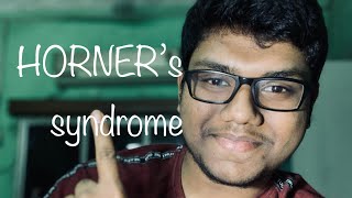 Horners Syndrome  Anatomy  Mbbs  Neet [upl. by Alamap]