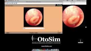 OtoSim™ Software Tour [upl. by Akinahc]