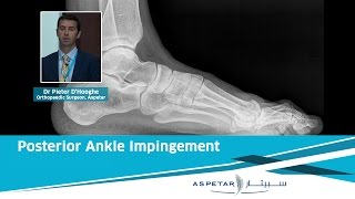 Posterior Ankle Impingement  Dr Pieter D’Hooghe Aspetar [upl. by Trescha281]