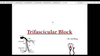 Trifascicular block Dr Akif Baig [upl. by Hecht]