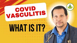 IS Covid Vasculitis a Silent KILLER [upl. by Carine738]