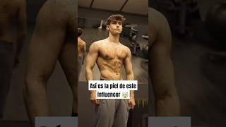 Así es la piel de este influencer gym fitness bodybuilding piel epidermis [upl. by Hahsia405]