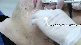 Achieve Glowing Skin with Diamond Microdermabrasion – Full Setup amp How to Use Guide [upl. by Atteuqehs]