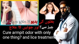 Treatment For Lice  Lice  Healthy Tips  Underarm Odor Treatment  DrHakeem Usman [upl. by Noemis884]