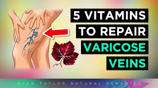 5 Vitamins For Venous Insufficiency VARICOSE Veins Remedies [upl. by Nairim]