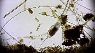 🔬 Rädertierchen Rotifer  Leben im Wassertropfen  microorganisms under microscope life in a drop [upl. by Ahsila]