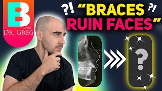 Braces Extractions DO NOT Ruin Faces [upl. by Addis]