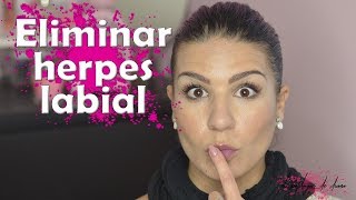 Herpes labial  MILAGRO natural para eliminarlo de inmediato [upl. by Alikam827]