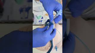 Intubation with a Videolaryngoscope 🫁🚑rettungsdienst ambulance paramedic hospital nurse [upl. by Oriane]